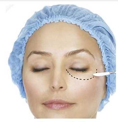 Toucas descartáveis (100 unidades)