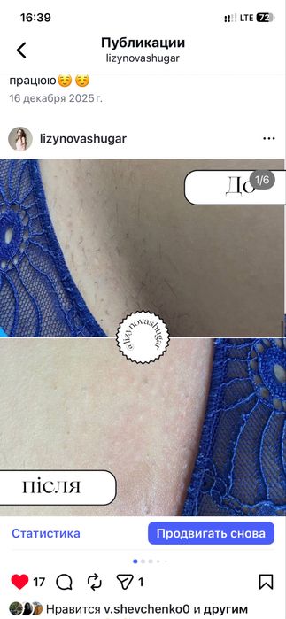 шугаринг, місто Суми, центр, бюджетно