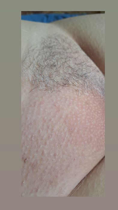 Депіляція шугаринг чоловічий,  жіночий