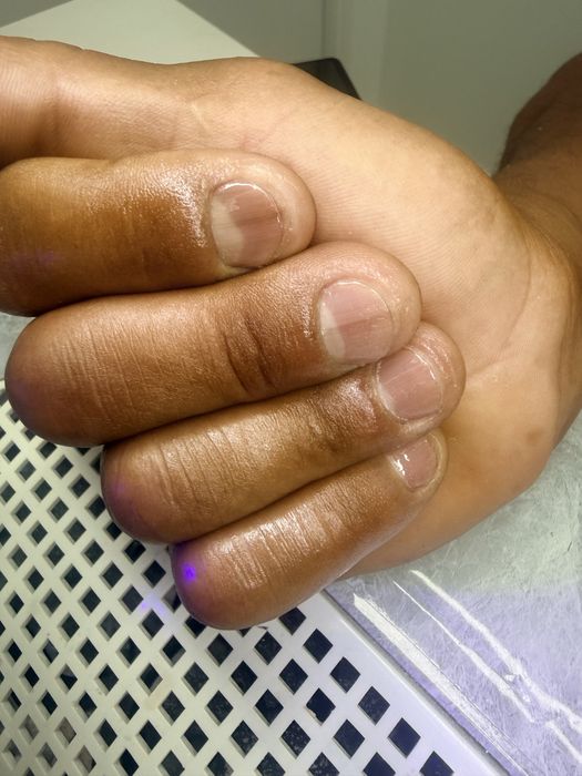Unhas molde F1.