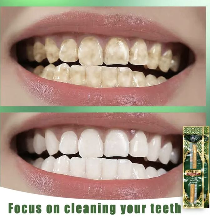 Місвак паличка (для чищення зубів) є Олх доставка