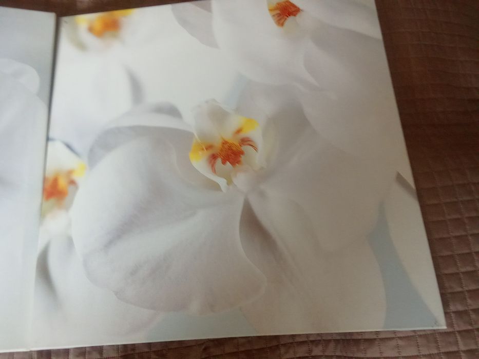 Conjunto Quadros tulipa