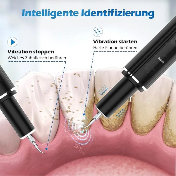 Ultradźwiękowe urządzenie do czyszczenia kamienia nazębnego