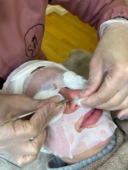 Limpeza de pele profunda