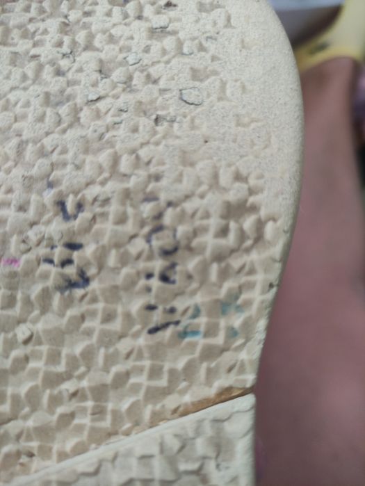 Ортопедичне взуття для дівчинки