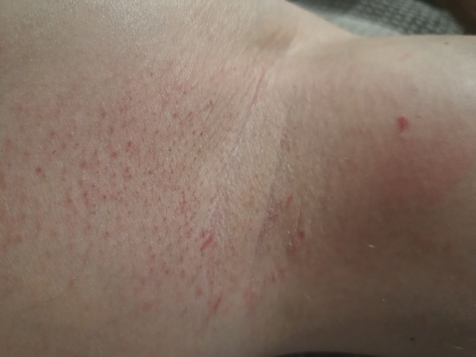 Знижка на Масаж на все тіло , урологічний, депіляція для чоловіка та ж