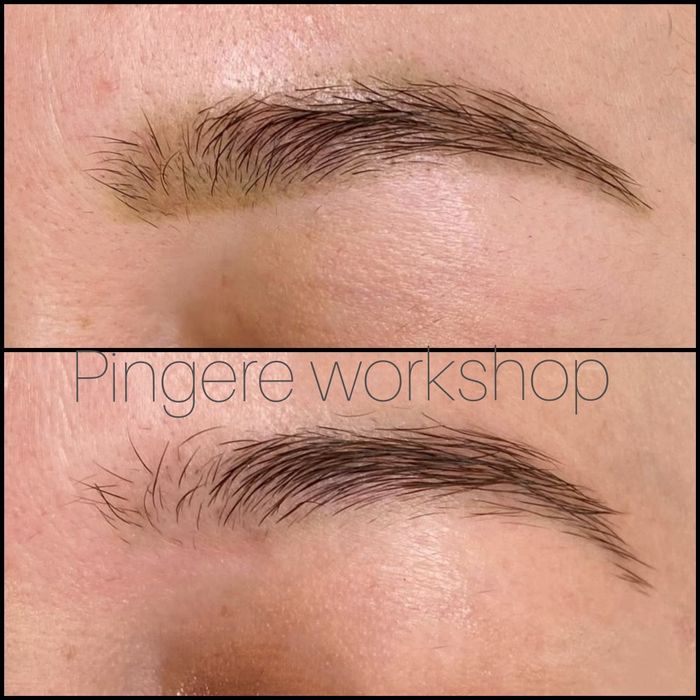 Безпечне лазерне видалення тату, татуажа.