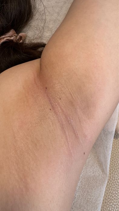 Шугаринг, депіляція  (р-н Бойова)