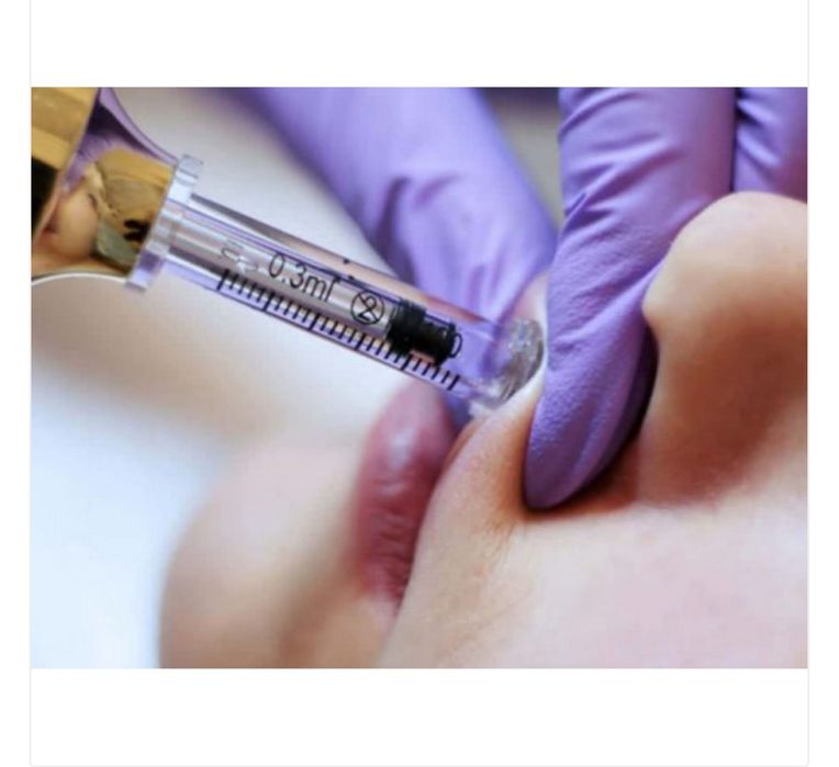 Hialuronowy długopis wypełniający