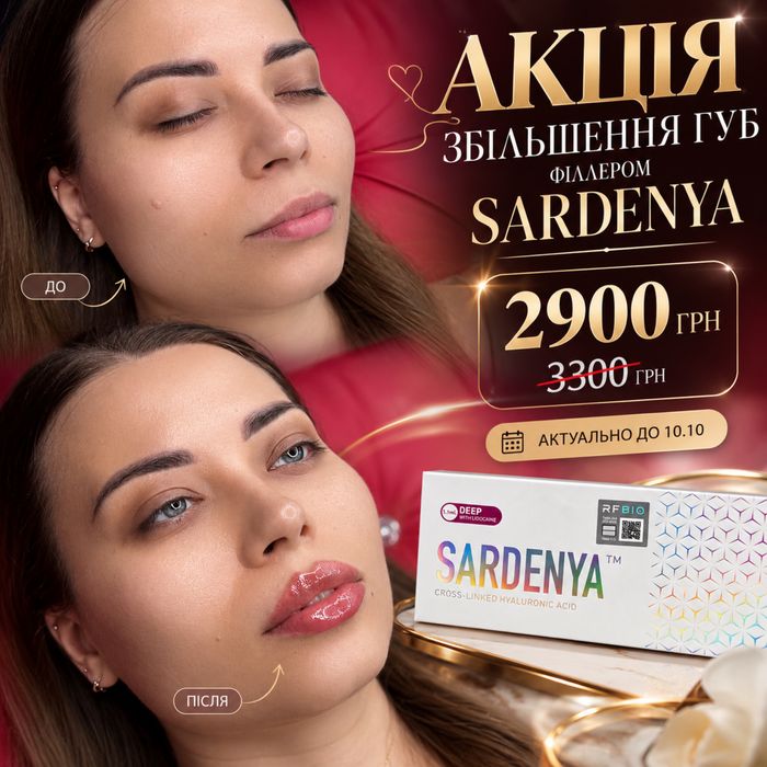 Акція! Косметолог, збільшення губ та інші іньєкціі, ботокс