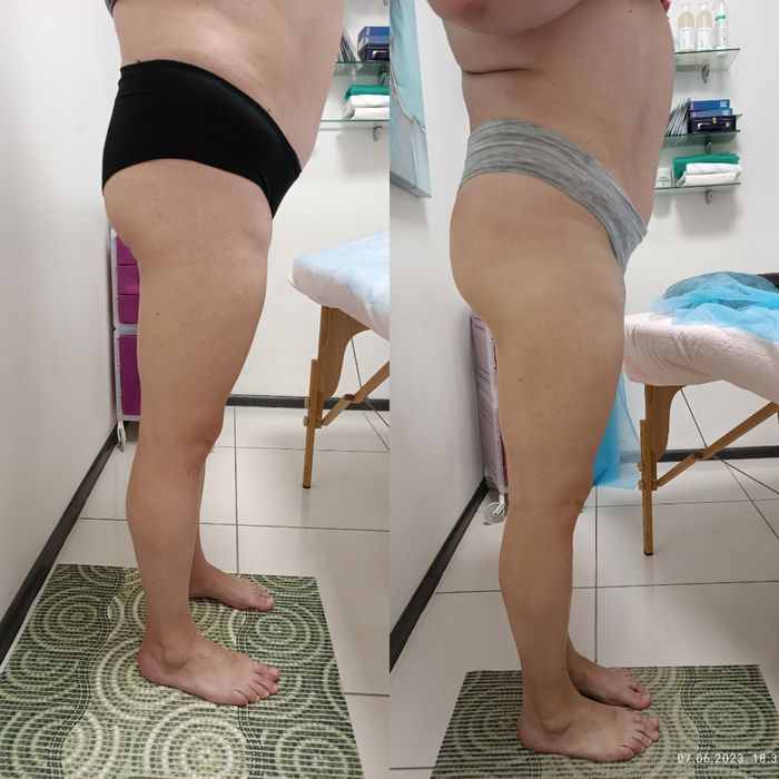 Масажист Троєщина, остеоп, корекція фігури.Масаж обли