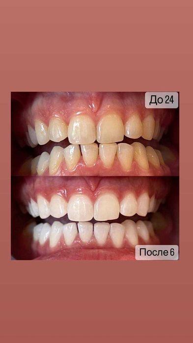 Косметичний бізнес / Франшиза відбілювання зубів Smile LAB