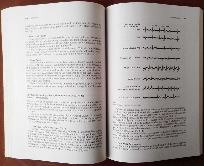 How to read Pediatric ECGs