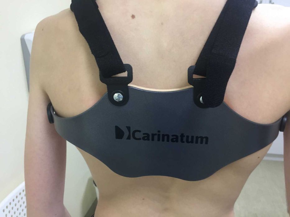 Ортопедичний корсет для грудної клітки