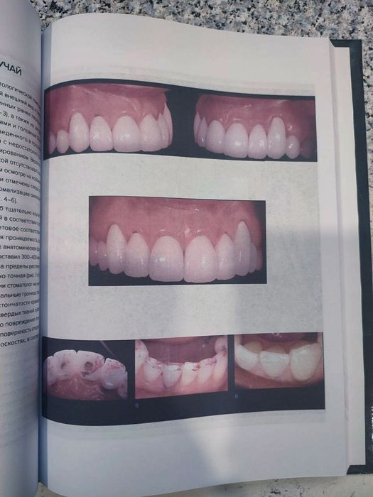 Внутрикорневые реставрации. Дуглас Терри. Стоматология. 2021