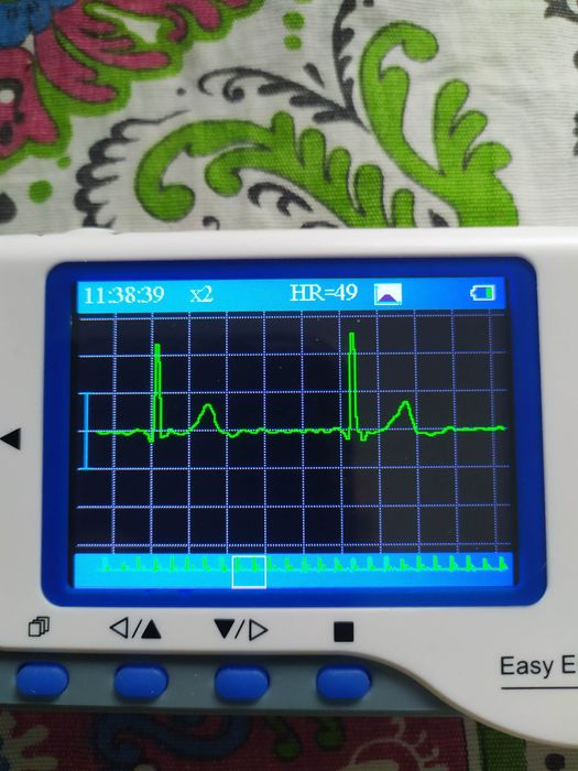 Портативный ЕКГ, PC-80B