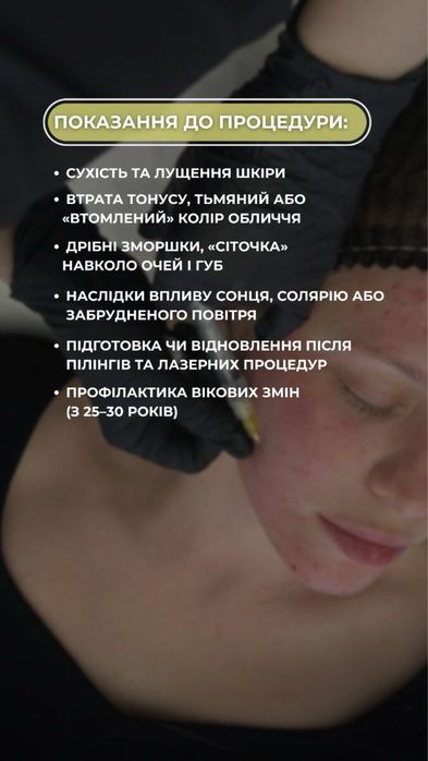 Треба моделі срочно