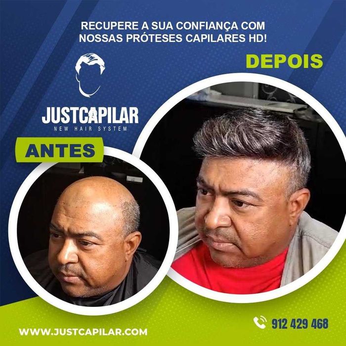 Próteses capilares, não é artigo Low cost, preço com iva incluido.