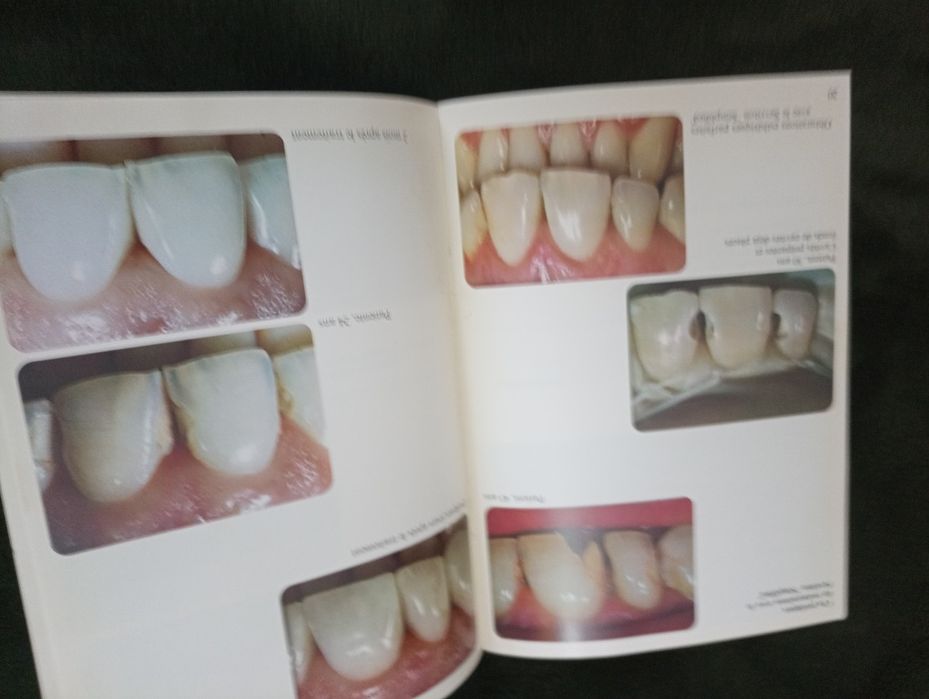 Sevitron Simplified - de dentiste à dentiste-  produto dentário 1949