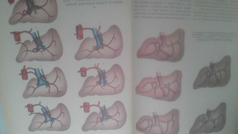 Атлас операций на печени 1975 год