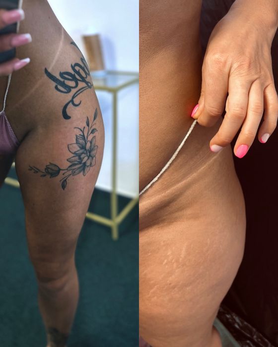 Opalanie natryskowe 100 tylko kobiety