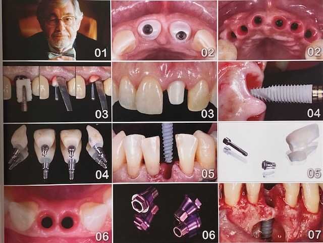 Integração: Os Caminhos da Implantodontia Estética