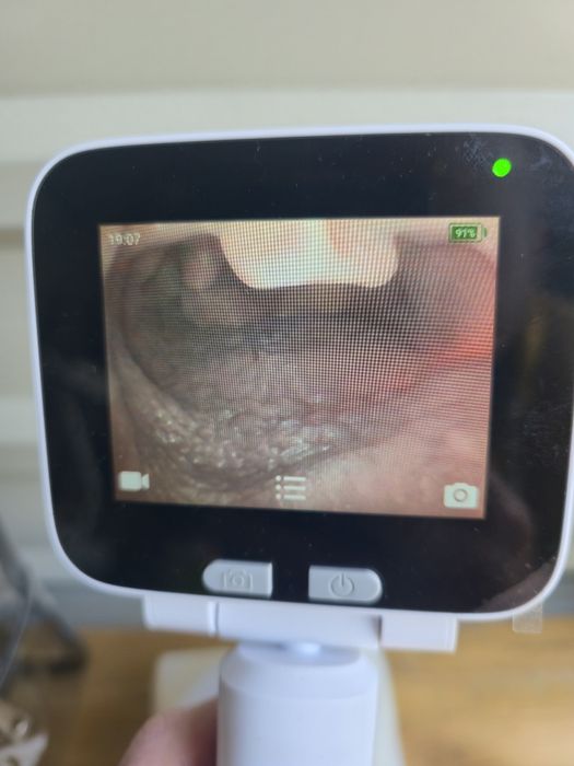 SIMEDU trenażer fantom do nauki intubacji dotchawiczej z zębami