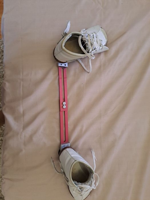 Брейси. Ортопедичне взуття для лікування клишоногості