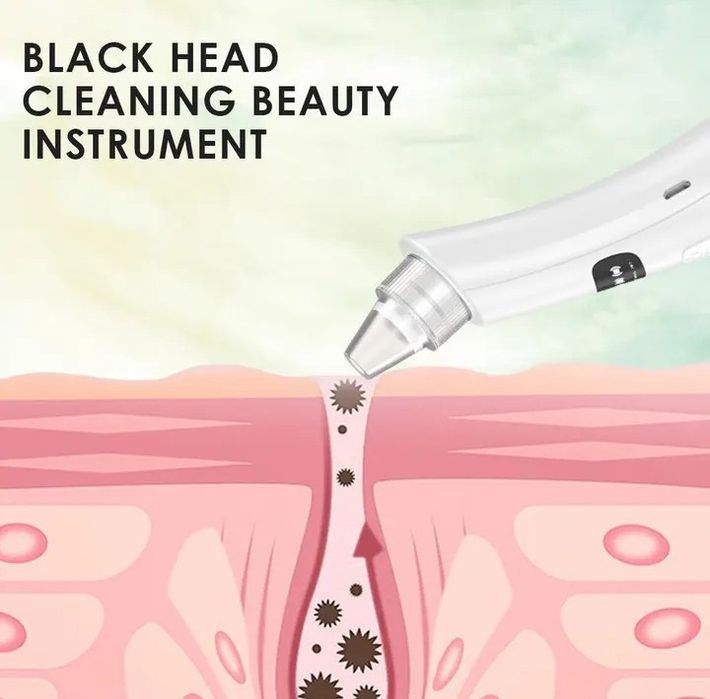 Вакуумный очиститель лица от угрей и точек. встроенный аккумулятор