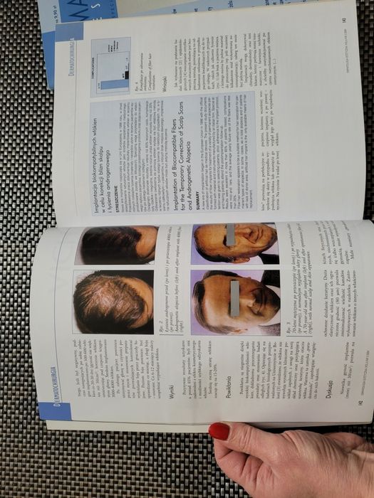 Czasopisma Dermatologia Estetyczna