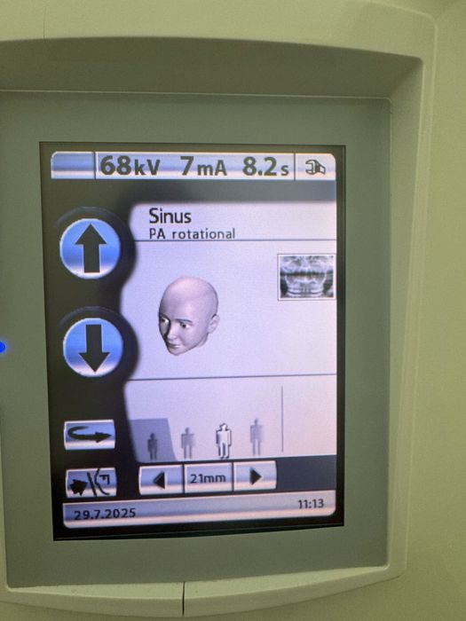 Ortopantomografo (rx panoramico)