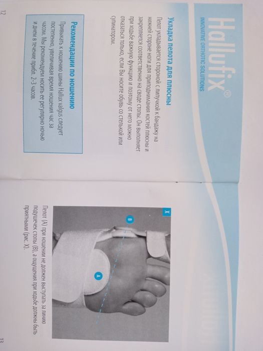 Оригинальная немецкая Вальгусная шина Hallufix Халлюфикс