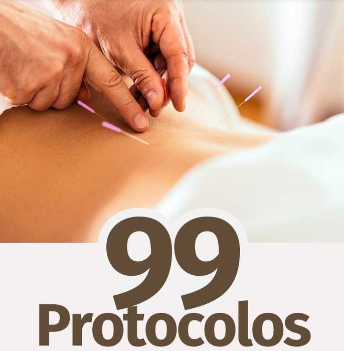 Manual 99 protocolos de acupuntura