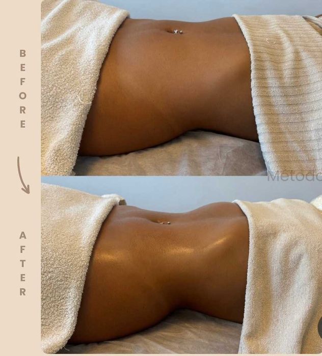 Formação estética