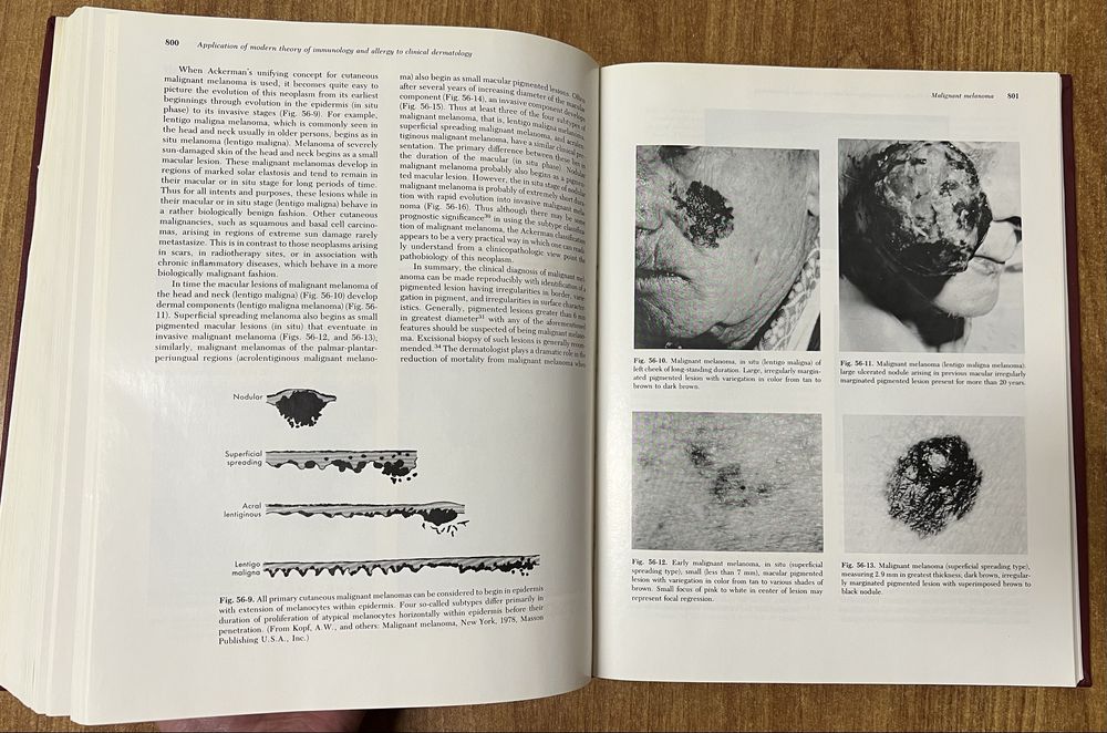“Dermatologic Immunology and Allergy” edited by Julius Stone