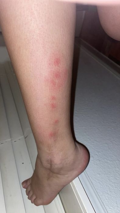 Desinfestação de Percevejos & Baratas em Lisboa & Margem Sul