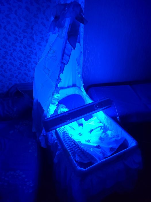 Продам лампу от желтушки