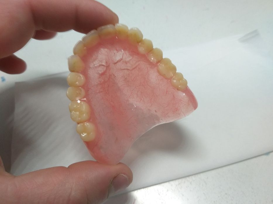 Зубний технік. Зуботехнічна Лабораторія  "Dental LAB"