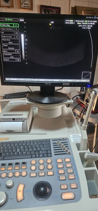УЗД апарат SONOACE SA-8000 Livе
