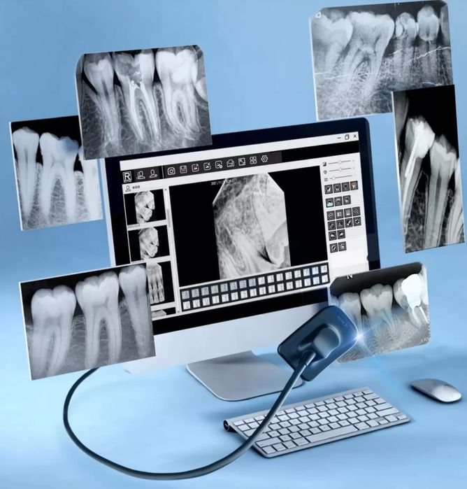 Візіограф R-1 Refine