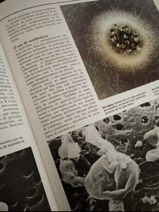 Livro "Micróbios" 1985