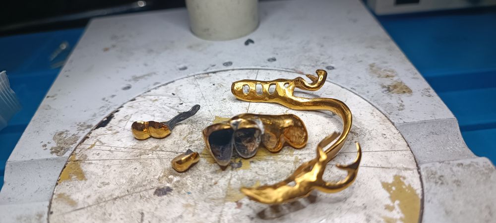 Стоматологическая позолота коронки