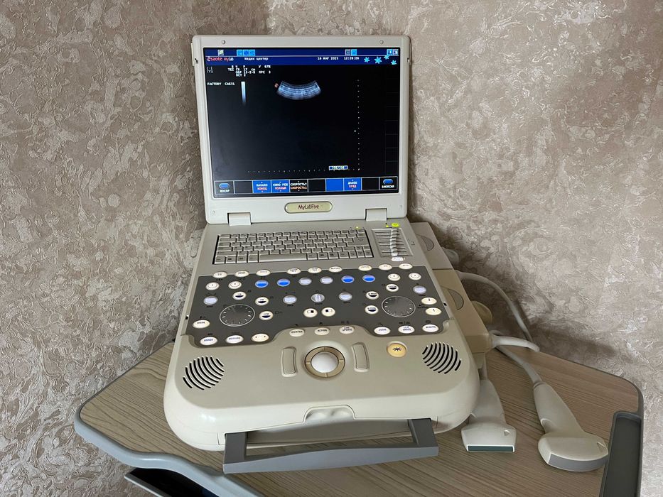 УЗД апарат ESAOTE MyLab Five