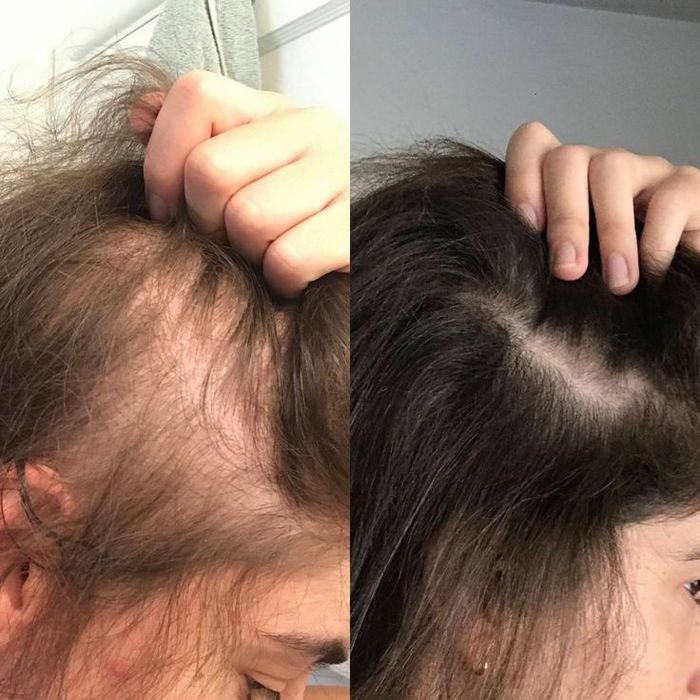 Tratamento natural " PELE E CABELO "