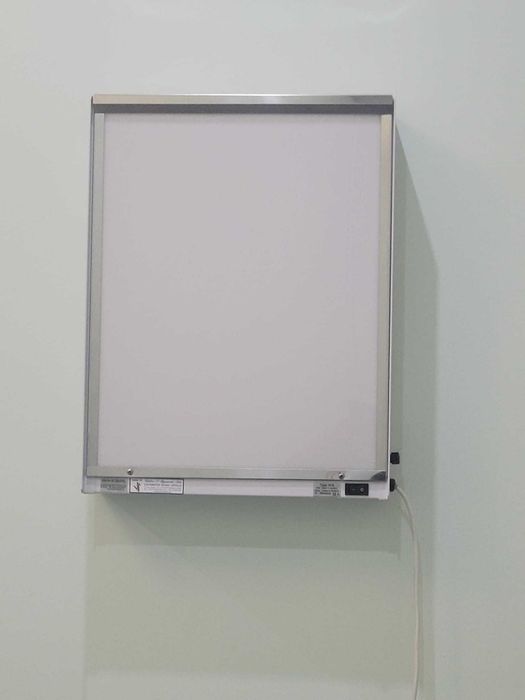 Negatoscópio 1 corpo, em chapa de aço inoxidável como novo