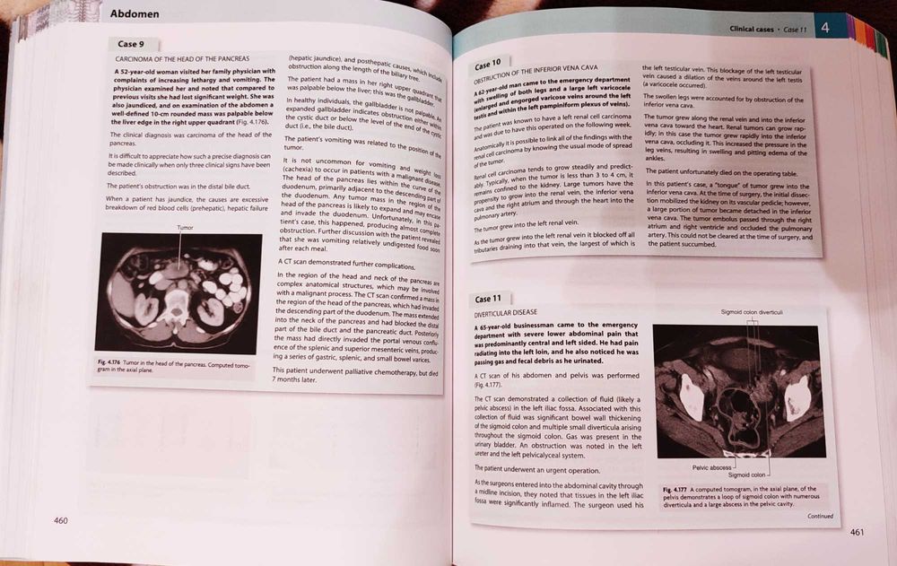 терміново. продам Підручник анатомія Грея. Gray’s anatomy