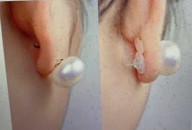 zatyczki do kolczyków  podnoszące - kolczyki