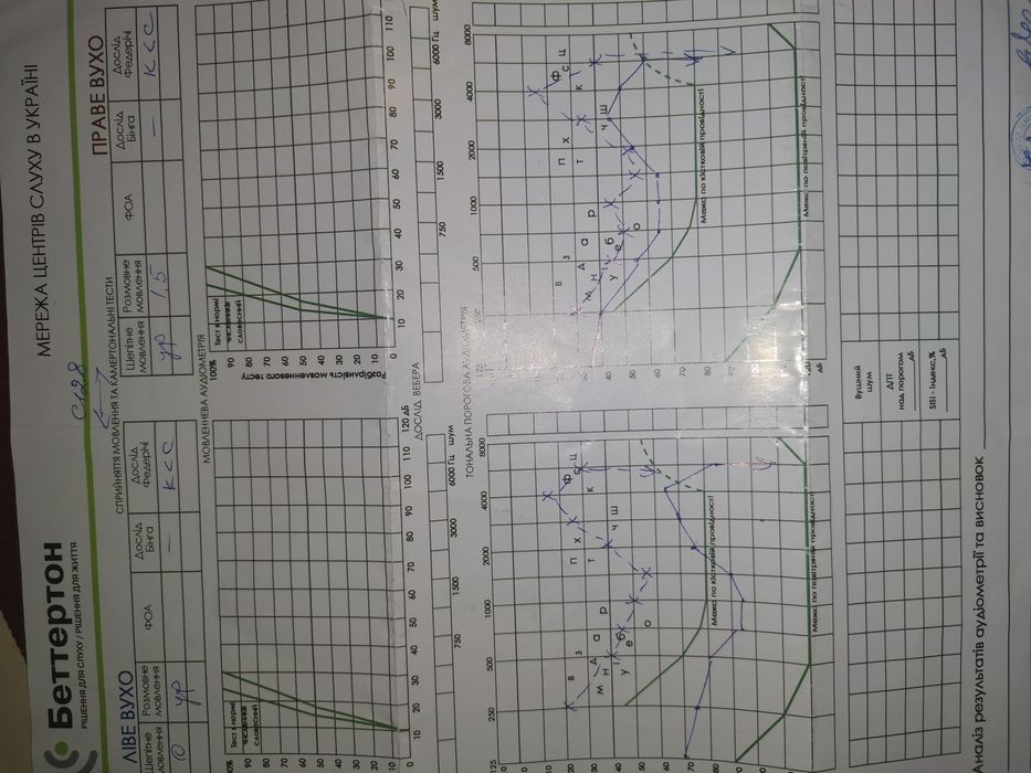 Слуховий  пристрій Starkey Aries Pro BTE 675 (ТОРГ)