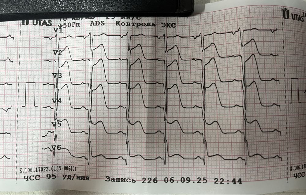 Кардиограмма на дому