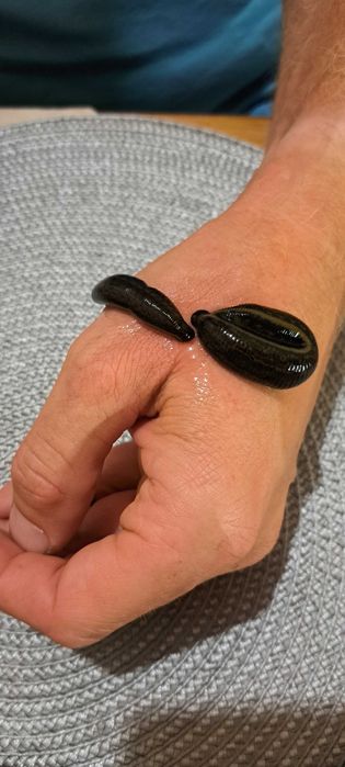 Zabieg hirudoterapii, pijawka lekarska, naturalna metoda :)